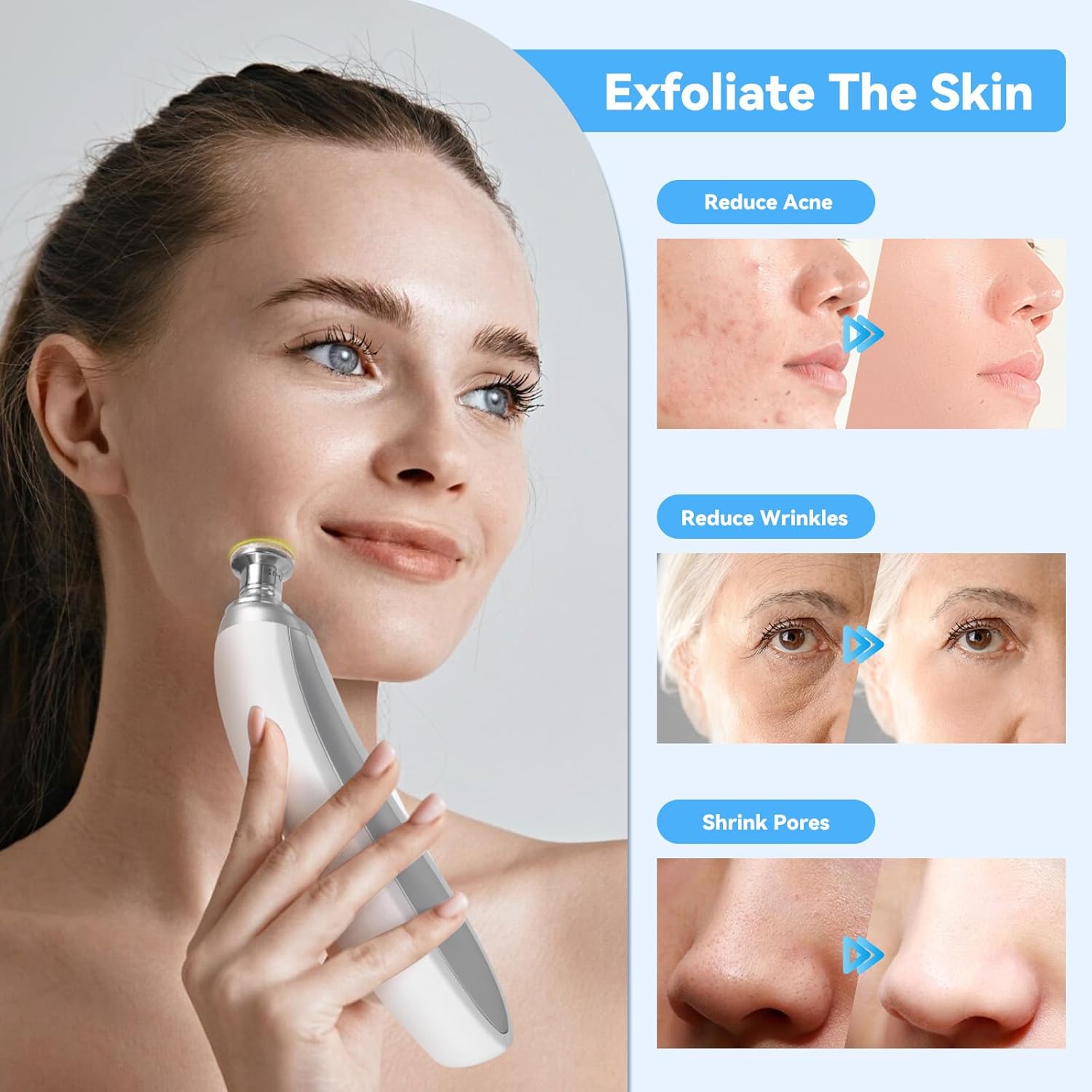 Upgraded Diamond Micro-Dermabrasion Facial Machine, Professional Facial Deep Cleasing Tool, Home Use Facial Skin Care Equipment